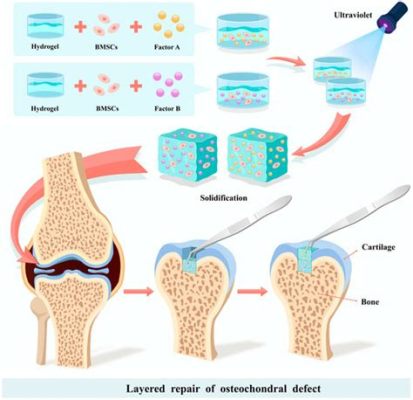  Dextran:  Vật liệu sinh học lý tưởng cho ứng dụng tái tạo mô và phân phối thuốc?